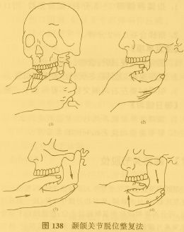 2197153dfd2e2467-fb3fdf2cd1d38d3c-aab73c62e218badc721a8a88a31effbc_i.jpg